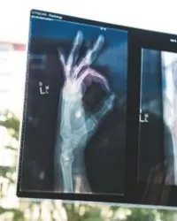 Medical_xray